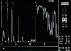 Biometria ultrassônica